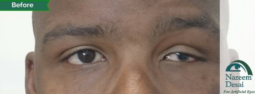 21