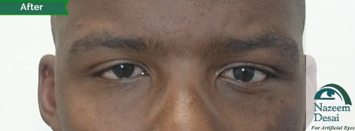 22